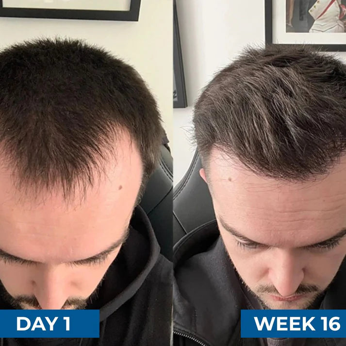 Hair Growth Roll-on